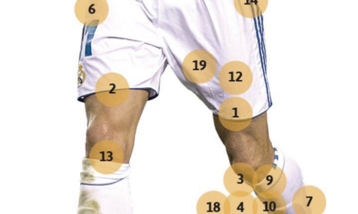 Wszystkie kontuzje Garetha Bale'a w Realu Madryt....