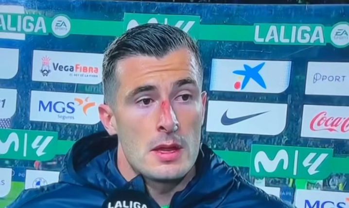 Tak wyglądał NOS Inakiego Peni po meczu z Realem...