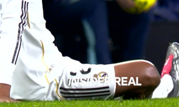 KONTUZJA w Realu Madryt! Podstawowy gracz wypada na 2 miesiące!