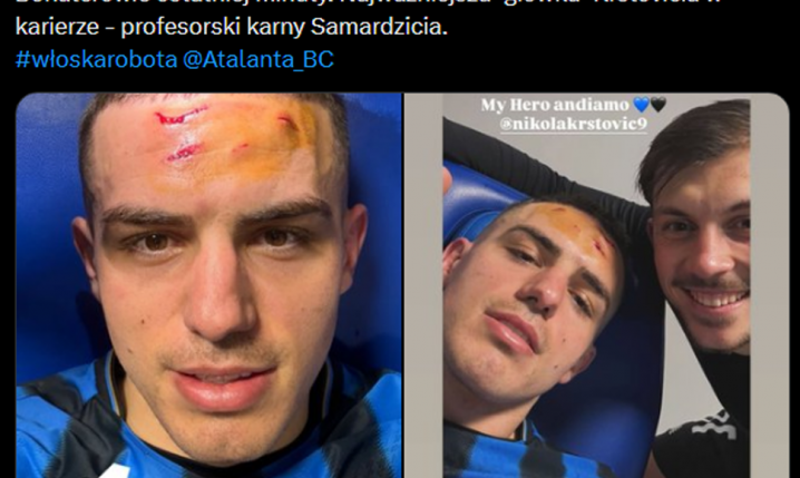 Nikola Krstović pokazał, jak wygląda jego twarz po wejściu piłkarza BVB