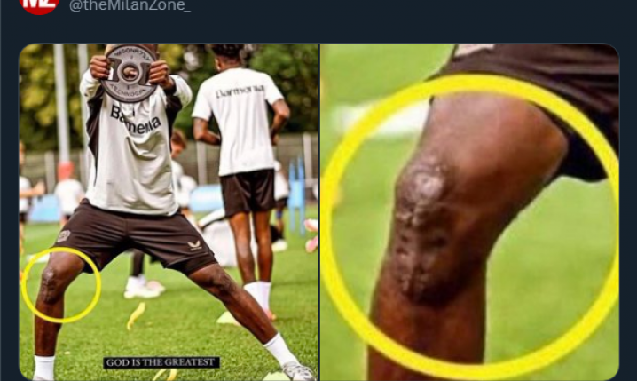 Tak wygląda kolano Victora Boniface'a! AC Milan wycofał się z transferu...