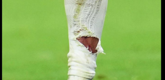 Tak wyglądała NOGA Kyliana Mbappe po wejściu Taha.. O.o