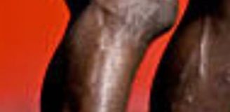 Alexander Isak i stan jego kolana...