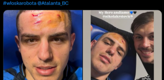 Nikola Krstović pokazał, jak wygląda jego twarz po wejściu piłkarza BVB