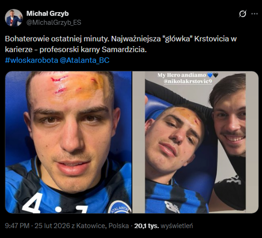 Nikola Krstović pokazał, jak wygląda jego twarz po wejściu piłkarza BVB