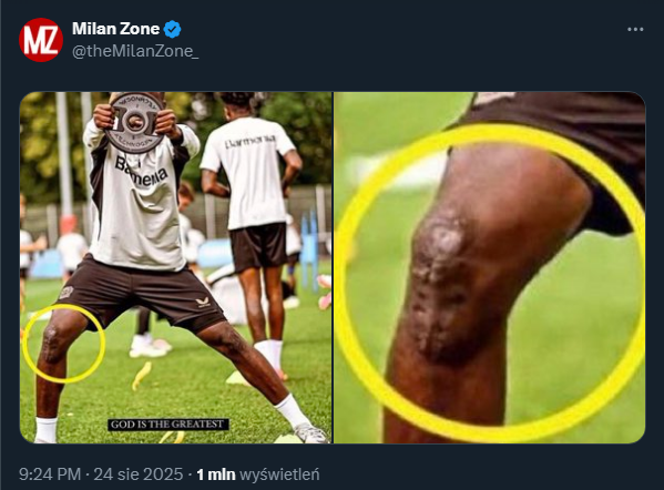 Tak wygląda kolano Victora Boniface'a! AC Milan wycofał się z transferu...