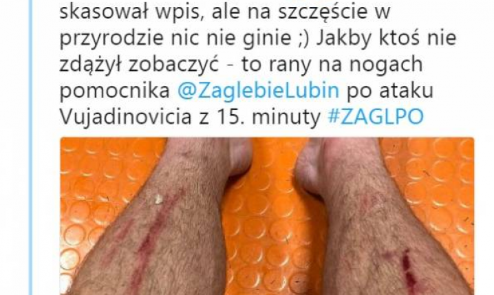 Nogi Filipa Jagiełły po wczorajszym wejściu obrońcy Lecha