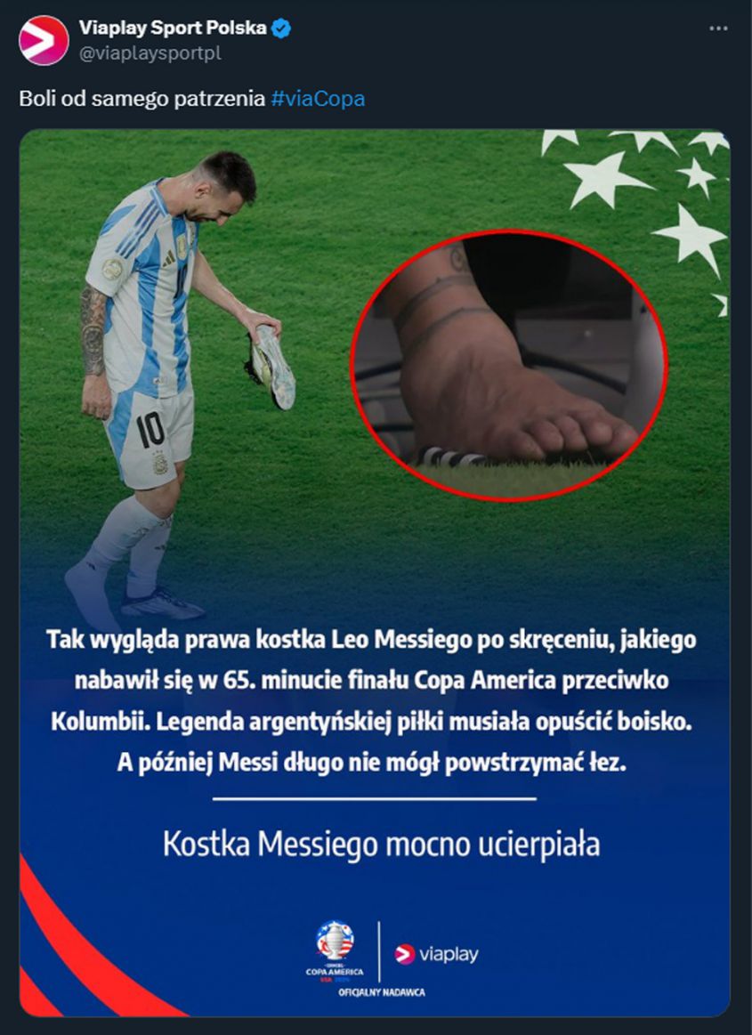 Tak wyglądała kostka Leo Messiego po opuszczeniu boiska...